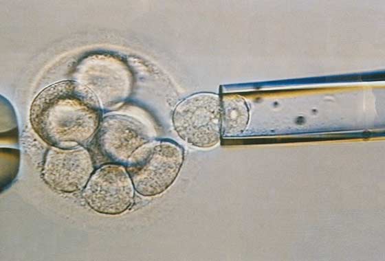 Преимплантационная генетическая диагностика эмбрионов